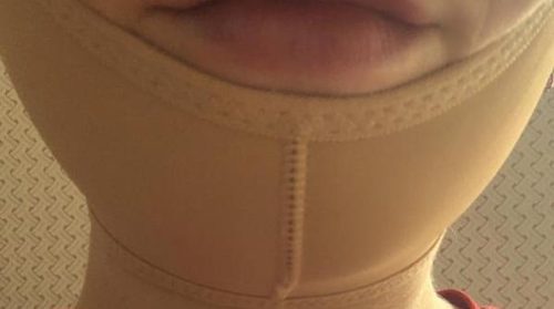 Dr. Lipo+ V photo review