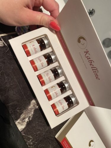 Kabelline review